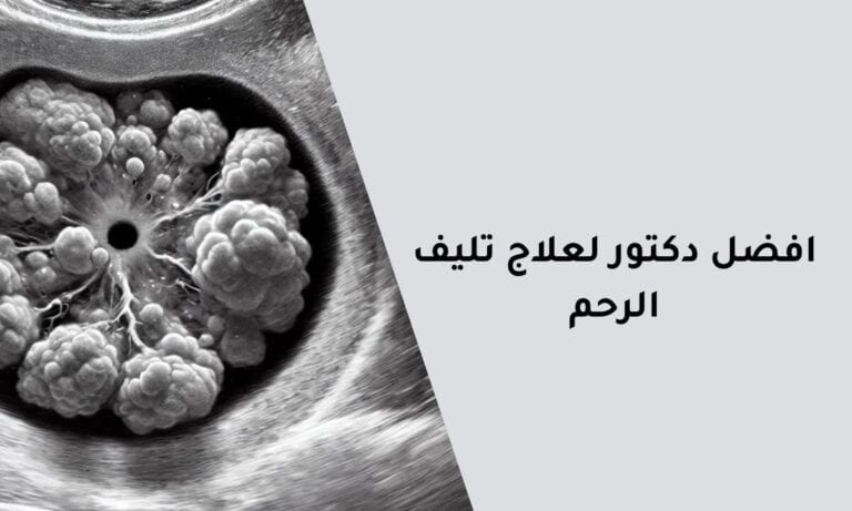 Best Doctor For Treating Uterine Fibroids