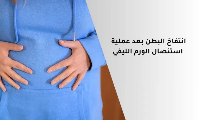 انتفاخ البطن بعد عملية استئصال الورم الليفي