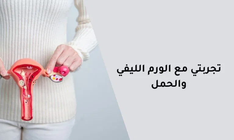 تجربتي مع الورم الليفي والحمل