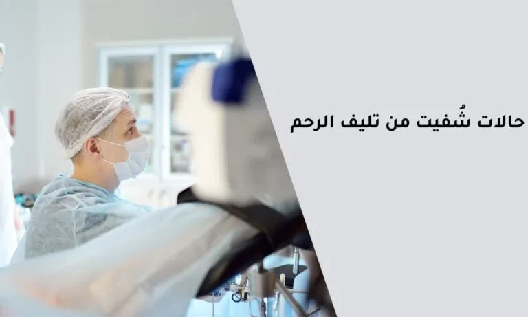 حالات شُفيت من تليف الرحم