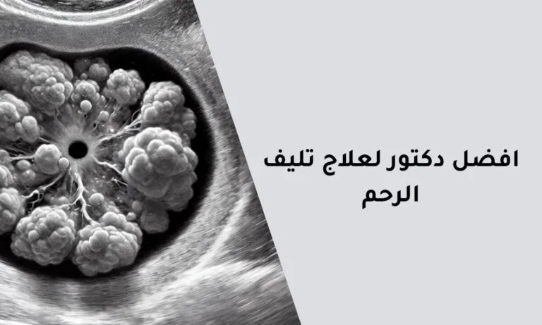 Best Doctor For Treating Uterine Fibroids