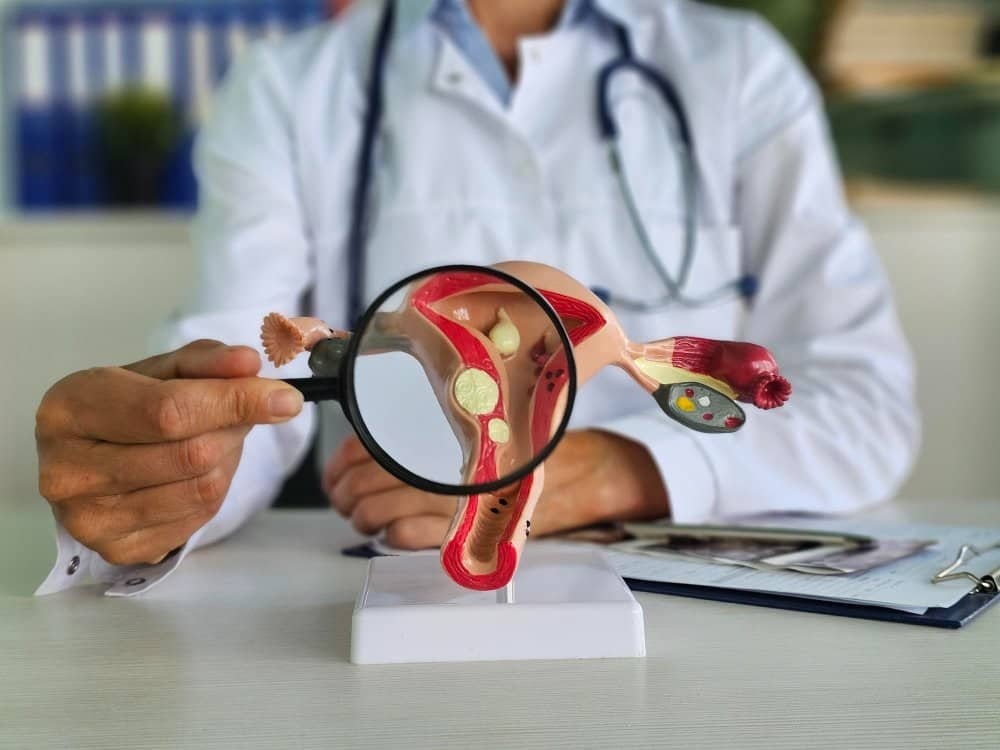 Best Treatment for Large Fibroids