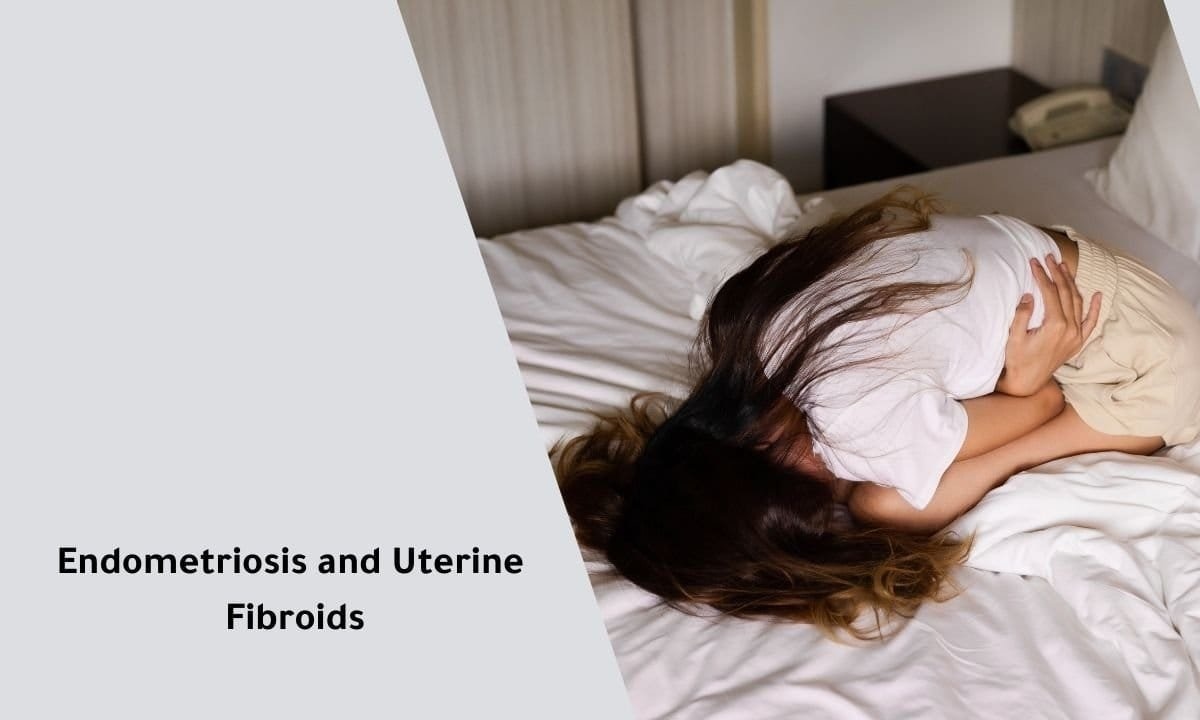 Endometriosis and Uterine Fibroids