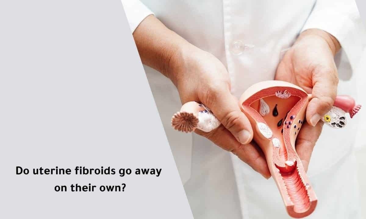 do uterine fibroids go away on their own