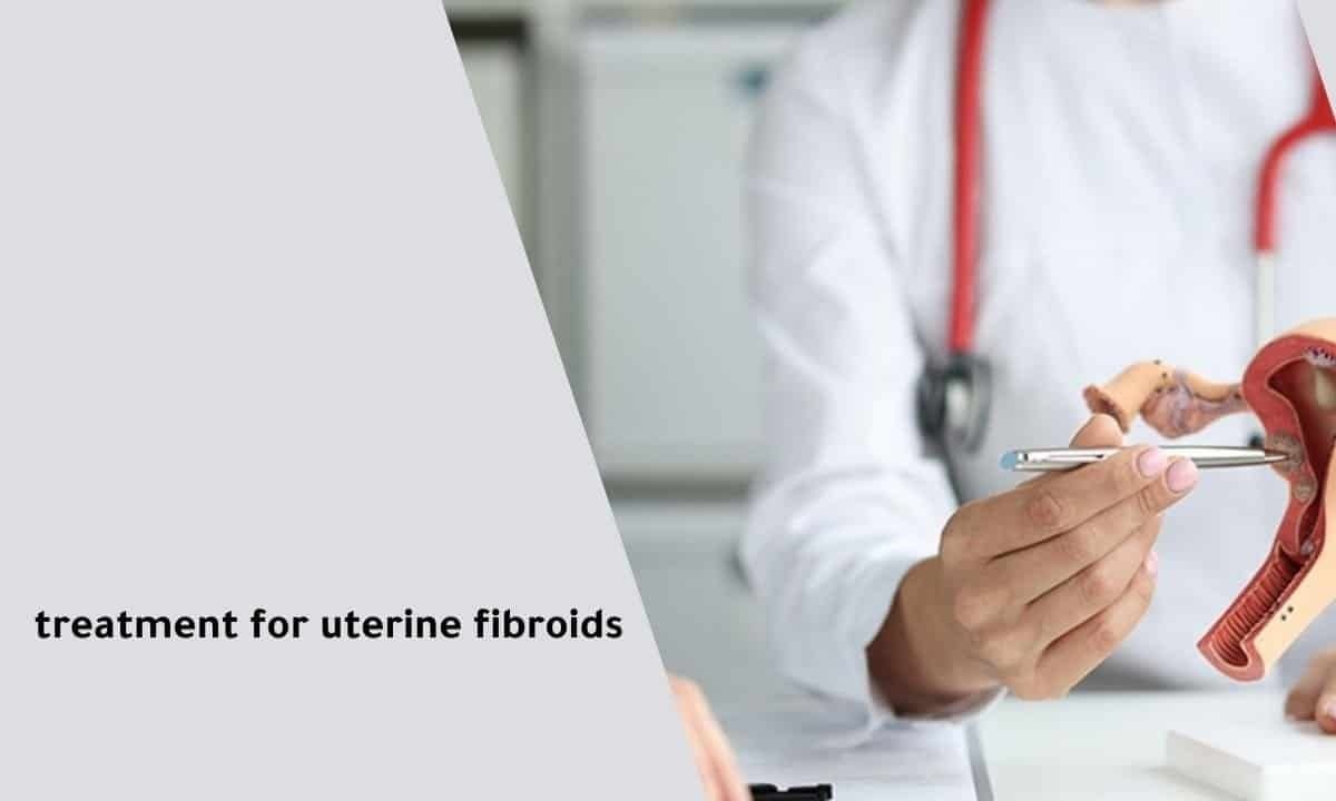 treatment for uterine fibroids