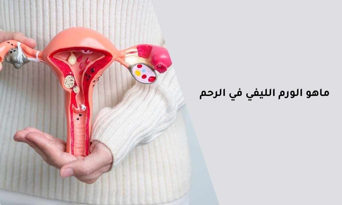 ماهو الورم الليفي في الرحم (1)